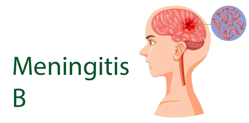 Service - Meningitis B Image