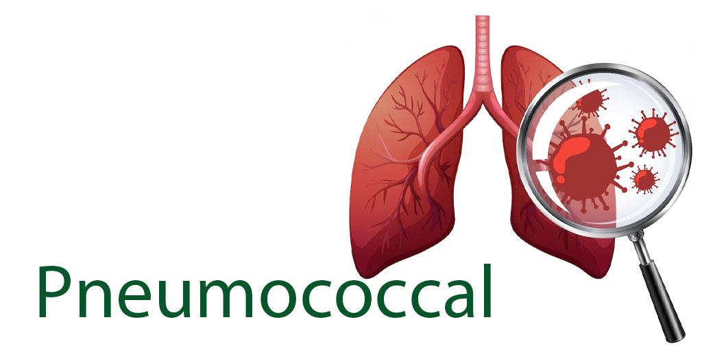 Service - Pneumococcal Image